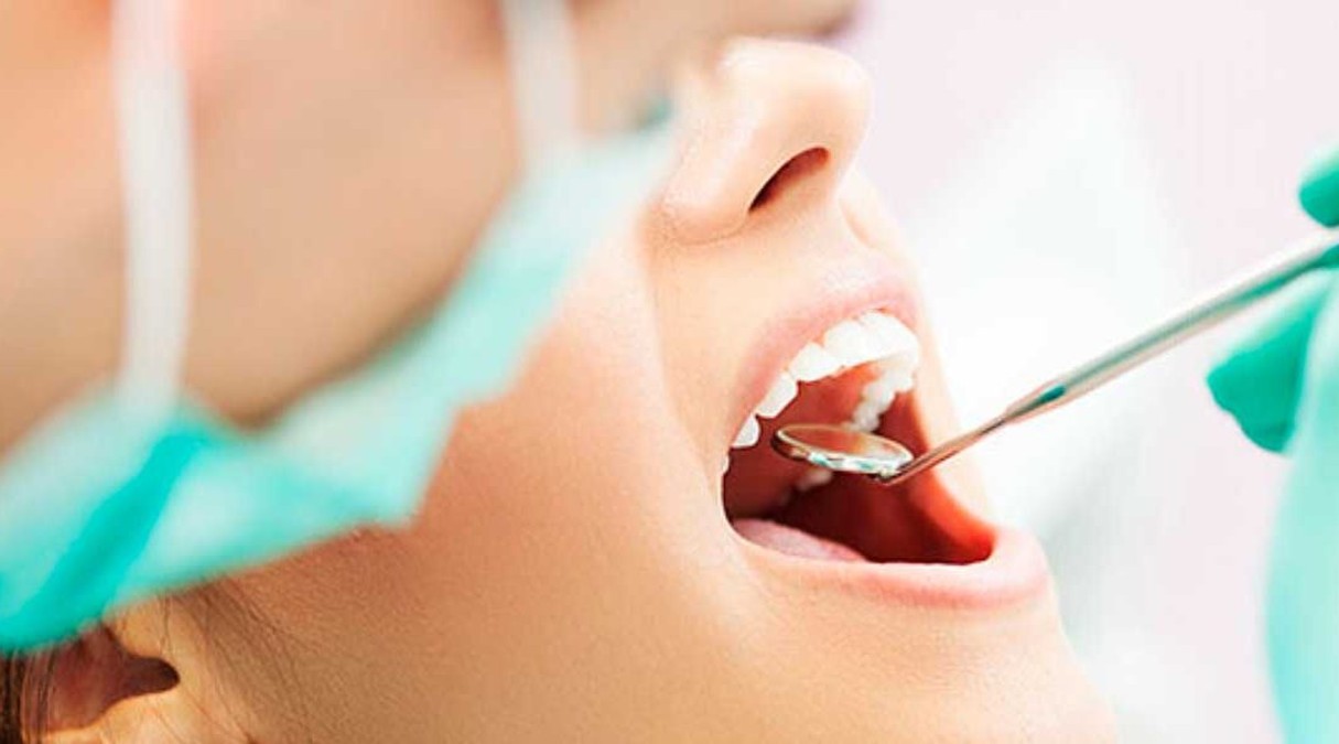 boca abierta para valoracion dental