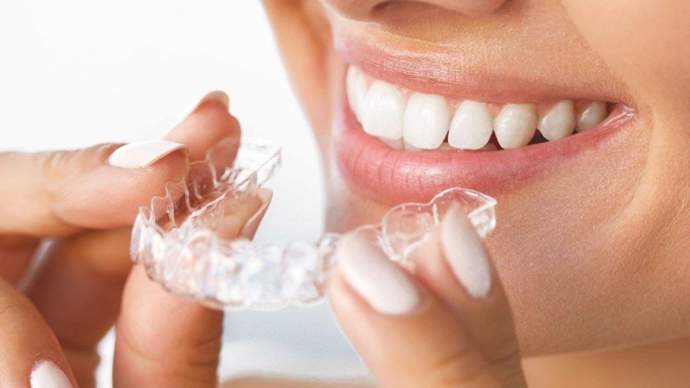 ¿Se produce movimiento de dientes tras la ortodoncia? Almara Dental