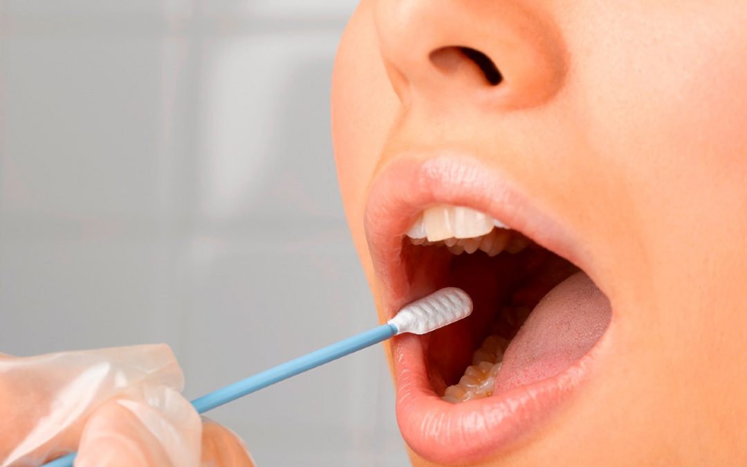 Por qué las heridas en la boca cicatrizar rápido tras una cirugía dental