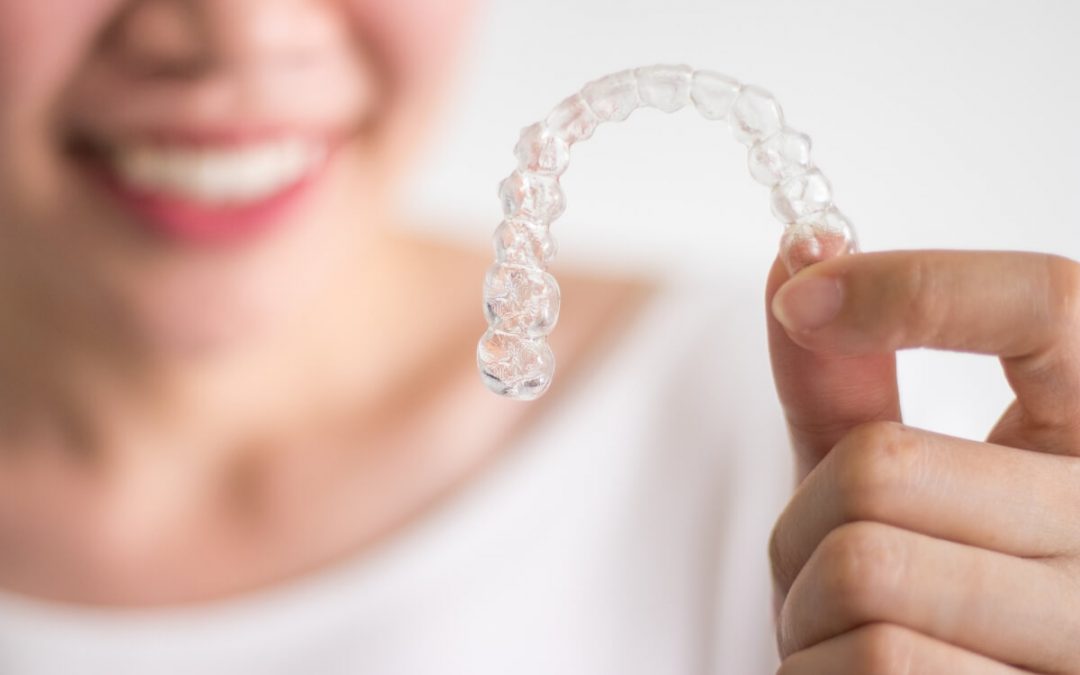 3 mitos y 3 verdades sobre la ortodoncia invisible