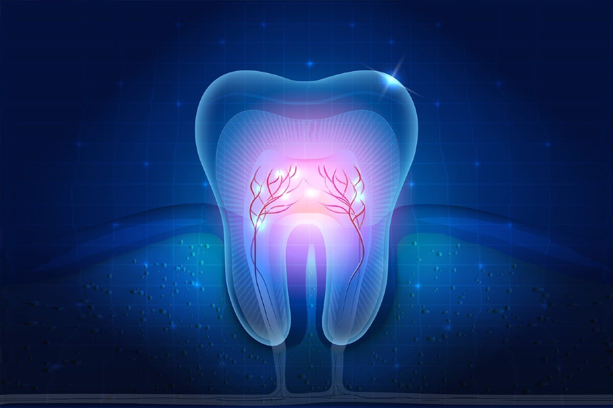 Corona dental despuÃ©s de una endodoncia